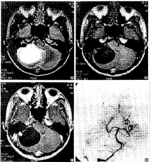 t11103.gif (27225 bytes)