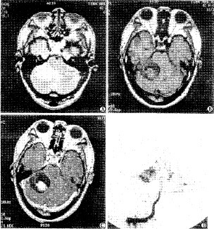 t11201.gif (24306 bytes)