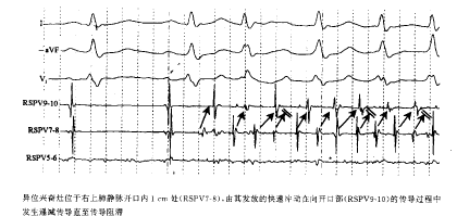 t2101.gif (10113 bytes)