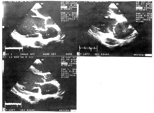 15.gif (134078 bytes)