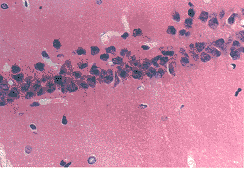 tb104.gif (18172 bytes)