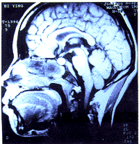 t14901.gif (15922 �ֽ�)