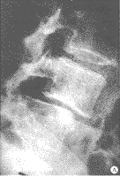 t79-1.gif (17436 bytes)