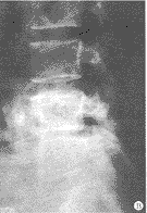 t79-5.gif (5323 bytes)