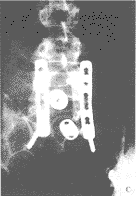 t79-6.gif (4298 bytes)