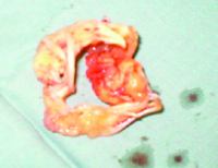 ���ȡ������׸����/����ժҪ/��������/��/��/