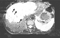 ������//