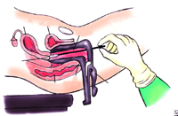 �����ӹ�����ǰ����ķ���//