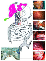 ���ҽԺ�ɹ��������������ǻ������������ֲ//