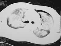 �ٴ��������ۡ������ȡ����ԡ���Ѫ/����ժҪ/��������/����/