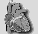 ������ͬ����Ϊ��˥���������辶//