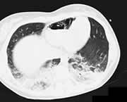 ���ľ������ܲ����¾���˨��֢//