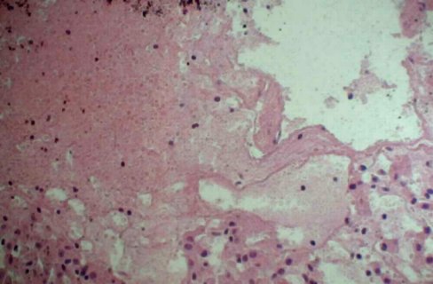 �����ϰ߲�//