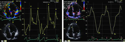 �¼����ļ�Ӧ�估Ӧ��������//