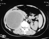 Ӱ��ѧ��Ƭ�����෿����������//