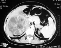 Ӱ��ѧ��Ƭ�����෿����������//