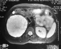 Ӱ��ѧ��Ƭ�����෿����������//