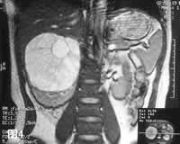 Ӱ��ѧ��Ƭ�����෿����������//