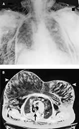 ���ܴ��׺���Ƥ������//