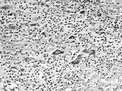 �ٴ��������ۡ���Ƥ��������ѡ������״�/����ժҪ/��������/�������/1.��ϸ�����ļ���/���ķ�������������/����ʧ��(�����Խ��������ɡ�Ƶ�������粫�������ݲ�����)��/ȫ�Ĺ���˥��(����Ѫ����ˮ�ס�����Ѫ)/��Դ���ݿˣ��������/2./ҩ��/