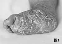 �ٴ��������ۡ����������Ͱ�����Ƥ��/����ժҪ/��������/ֻ�л���Ѫ��19S-IgM-FTA-ABS�������Բ���������÷����ϵ�����֤�ݡ�/