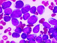 ͷʹ��Ż�£���ϸ�����ߣ�ѪС�����/��������/