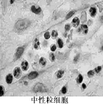 �����������ƴ�״�������Ч//