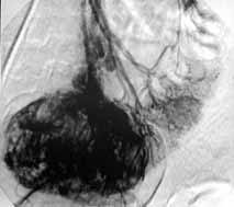 Ѫ����Ӱ��С����Ѫ�Լ�������¼���(ͼ)//