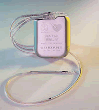 ����ʽ������Ԥ���������Ч���//