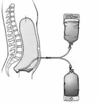 �����������Ľ� ��߸�Ĥ͸������