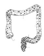 �ô󳦰�����ԭ��(��ͼƬ4��)(���󲡷��Ρ��󳦰�����ƪ��)