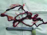 �ζ���Ѫ˨����1�� ��������ɹ�ȡ��