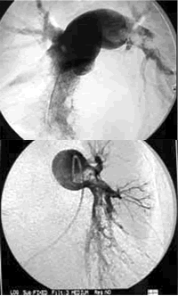 �ζ���Ѫ˨����1�� ��������ɹ�ȡ��