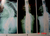 ����Э��ҽԺ���ζ�ͯ�����������ҵ��//