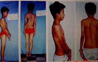 ����Э��ҽԺ���ζ�ͯ�����������ҵ��//