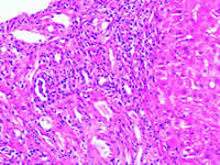 ��ؽ�ʹ�����ȡ�����//