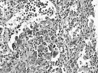 ���ȡ���Ƣ�״�//