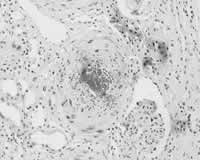 Ƥ���ʹ��������˥//