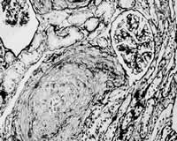 Ƥ���ʹ��������˥//