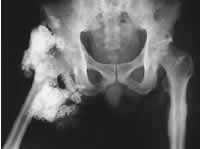 ���Լ�״���ٹ��ܵ��°��Źؽ���Χ���ƻ�//