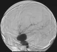 ���żӽ���������ͯ����­�ڶ�����//