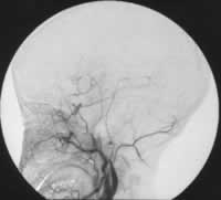 ���żӽ���������ͯ����­�ڶ�����//