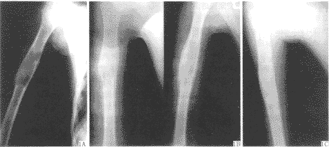 �����Ĥ���踴����ֲ�޸������Թ�ȱ��