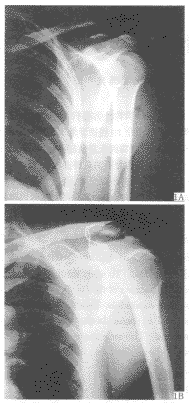 �������˲��ȶ����۵���������