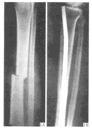 ���ڶ���������ǹ���45��