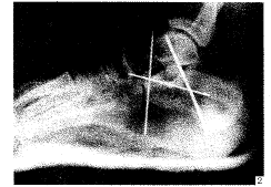 �������Ƹ��ǹؽ��ڹ���