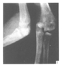 ��ؽڲ෽��λ3��