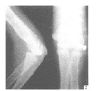 ��ؽڲ෽��λ3��