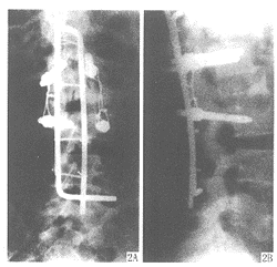 ׵��׵��Ш�νع�������׵��͹�鲻ȫ̱