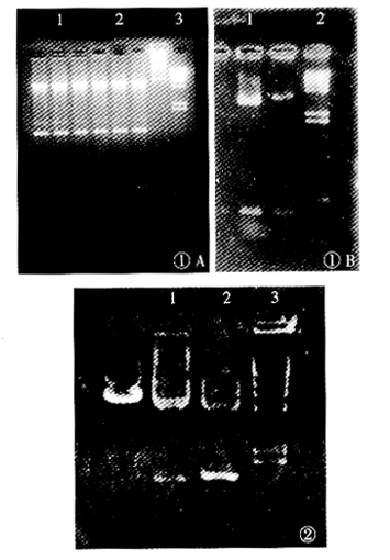 Construction of retroviral vector containing HSV-tk gene for colorectal carcinoma tissue-specific gene therapy